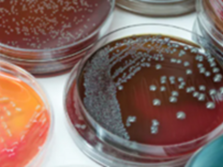 Bacterial culture medium with isolated growth.