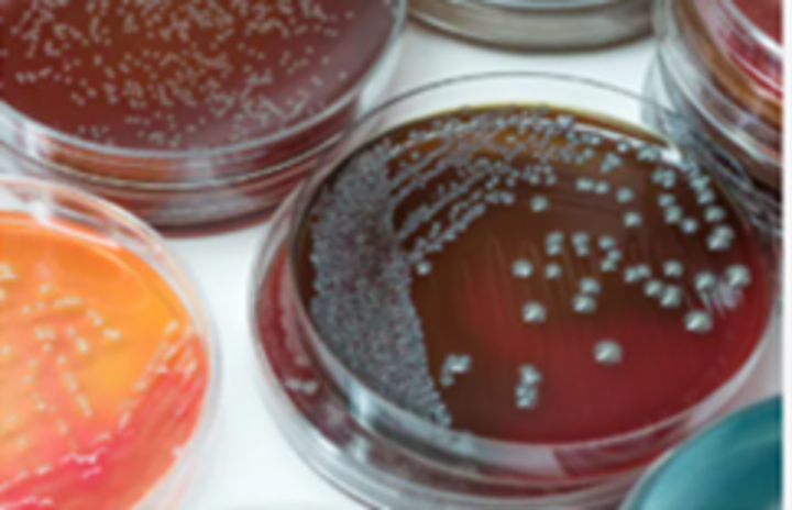 Bacterial culture medium with isolated growth.