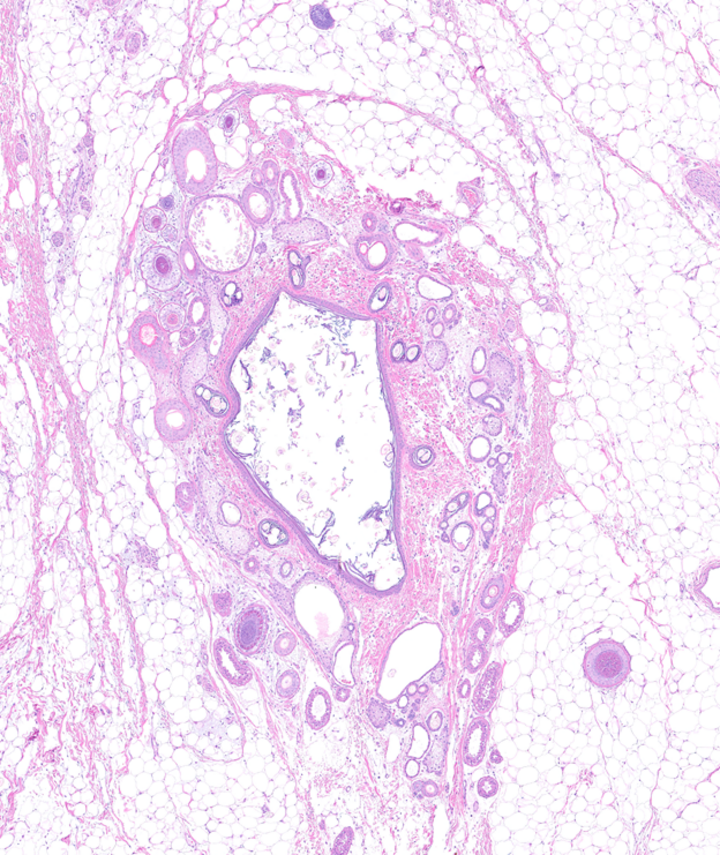 H&E stained section from an ovarian teratoma in a Labrador retriever. 