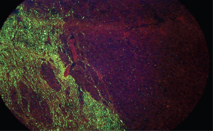An image from Direct fluorescent antibody (DFA) testing that is positive for rabies.