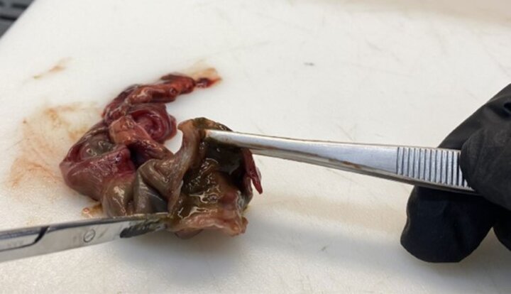 photo of an intestine sample
