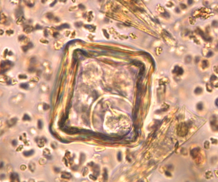 A slide image of Moniezia species ova on fecal flotation.