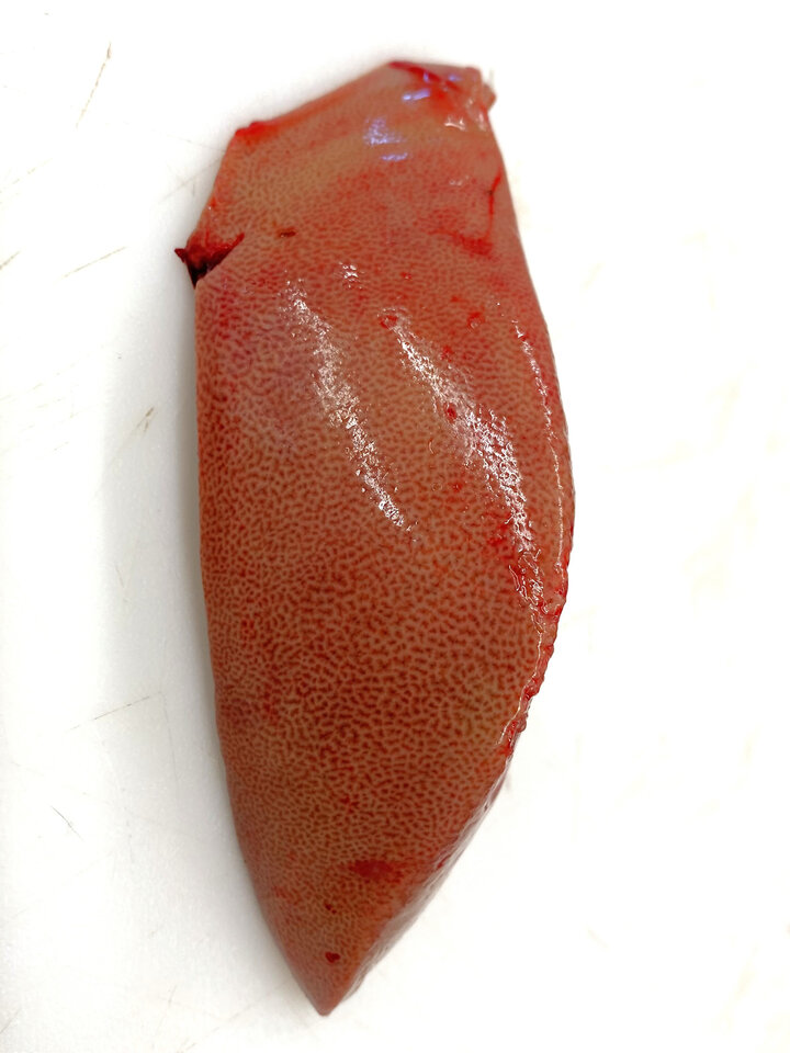 A doe liver that is diffusely pale with a pronounced lobular pattern.